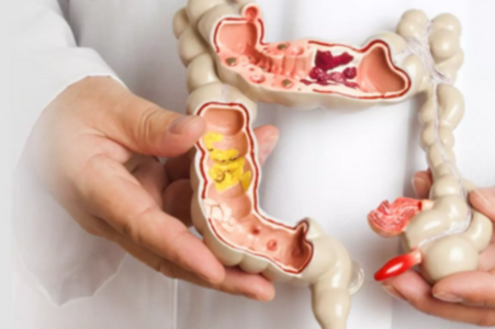 Colorectal Surgery