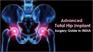 Advanced hip replacement