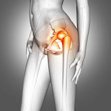 CGHS hip replacement Nagpur