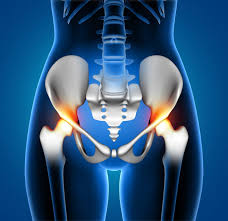 Quick recovery hip surgery Nagpur
