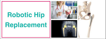 Cashless Robotic Hip Replacement In Chhindwara