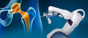 Robotic-assisted Hip Replacement In Hoshangabad