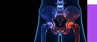 AVN treatment Mandla