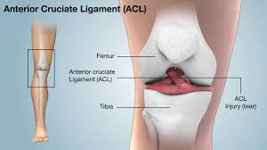 Acl ligament treatment Itarsi