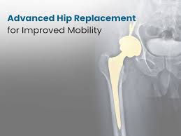 Advanced Hip Replacement In Katni