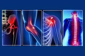 Ayushman Bharat Orthopaedics In Katni