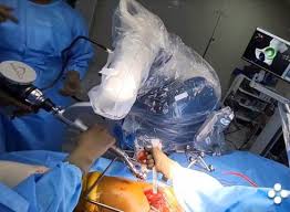 Best Robotic Hip Surgeon In Itarsi