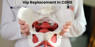 CGHS Hip Replacement In Shahdol