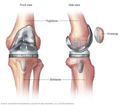 Knee replacement Shahdol
