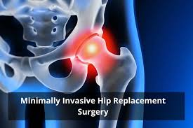 Minimally Invasive Hip Surgery In Bhandara