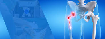 Minimally Invasive Hip Surgery In Gadchiroli