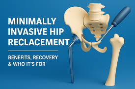 Minimally Invasive Hip Surgery In Betul