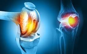 PMJAY Joint Replacement In Chandrapur