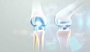 PMJAY Joint Replacement In Harda