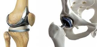 PMJAY Joint Replacement In Sagar