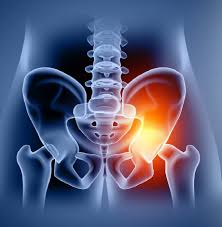 Quick Recovery Hip Surgery In Gondia