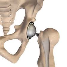 Quick Recovery Hip Surgery In Sagar