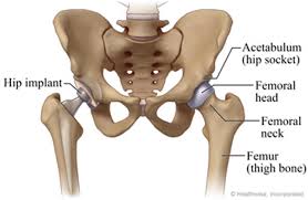 Quick Recovery Hip Surgery In Katni