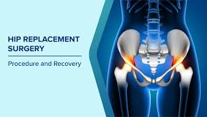 Quick Recovery Hip Surgery In Yavatmal
