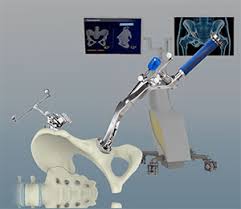 Robotic Hip Replacement In Katni