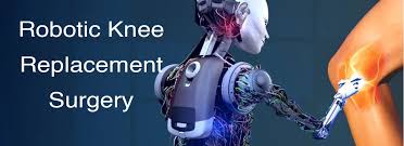 Robotic Knee Replacement in Chhindwara