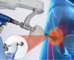Robotic-assisted Hip Replacement PMJAY In Amravati