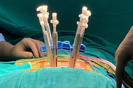 Spine Surgery in Gadchiroli