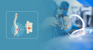 Spine Surgery in Mandla