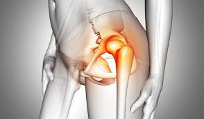 AVN treatment Bhopal