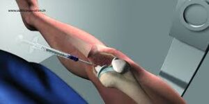 Government Approved Joint Surgery In Jabalpur