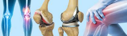 Joint Replacement Low Cost In Bhopal