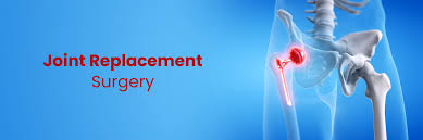Joint Replacement Low Cost In Gadchiroli