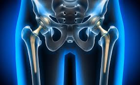 Minimally Invasive Hip Surgery In Bhopal