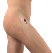 Precision Hip Replacement In Bhopal