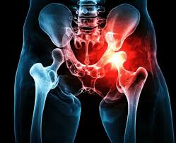 Spine Surgery in Chhindwara