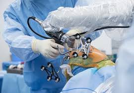 Robotic Hip Surgery In Balaghat