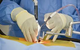 Spine Surgery in Chhindwara