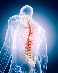 Spine Surgery in Rewa