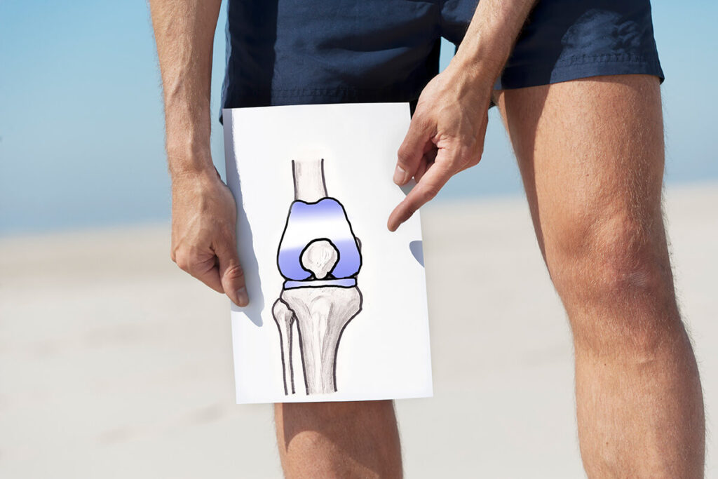 Cost of Knee Replacement in Nagpur