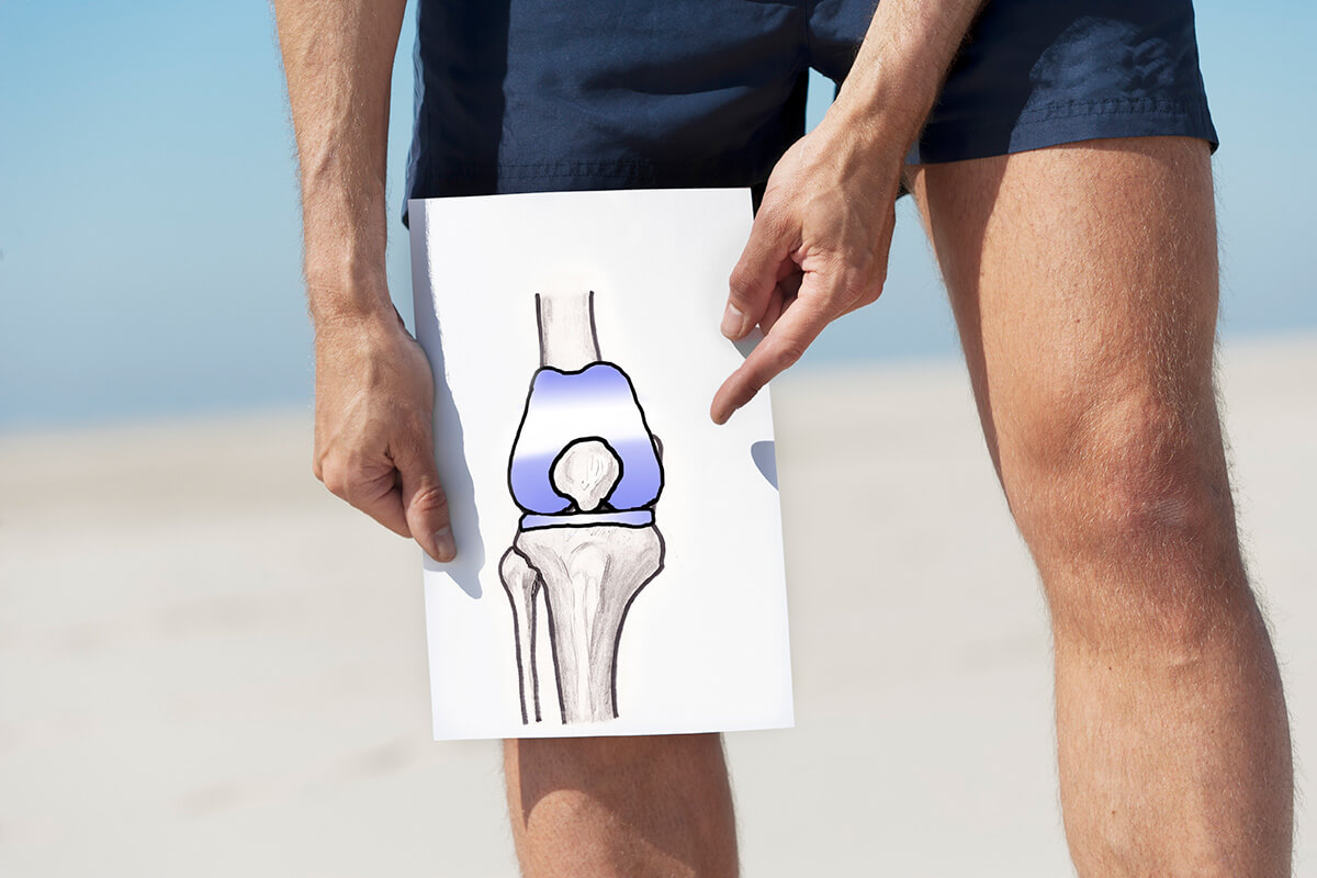 Cost of Best Knee Replacement in Nagpur