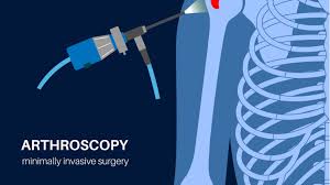 Arthroscopy Hospital In Nagpur
