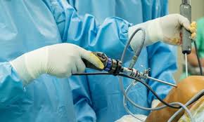 Arthroscopy Hospital In Nagpur