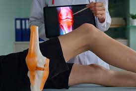 Best Joint Fracture In Nagpur
