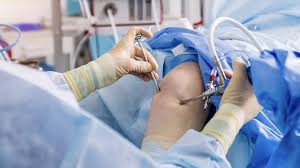 Best Knee Arthroscopy In Nagpur