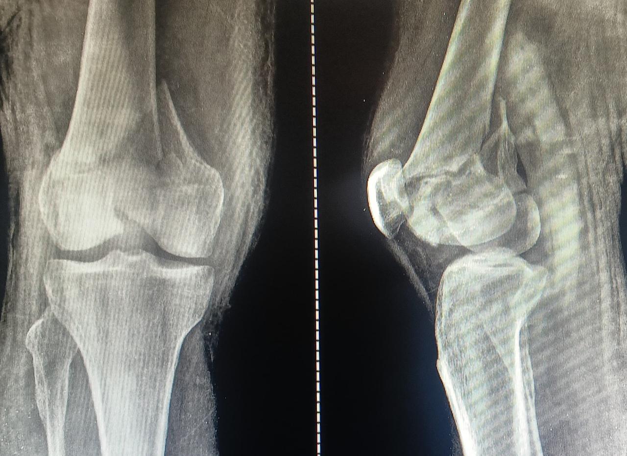 Best ortho hospital nagpur