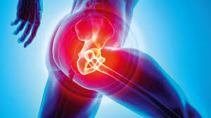 Free Hip Replacement Ayushman Bharat Nagpur