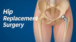 Hip Replacement Surgeon In Nagpur