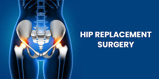 Hip Replacement Surgery In Nagpur