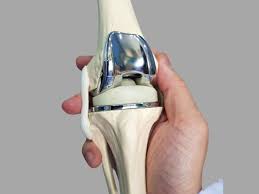 Joint Replacement Surgeon In Nagpur