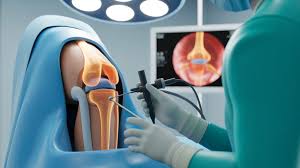 Knee Arthroscopy In Nagpur
